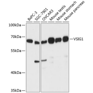 VSIG1 Rabbit Polyclonal Antibody