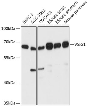VSIG1 Rabbit Polyclonal Antibody