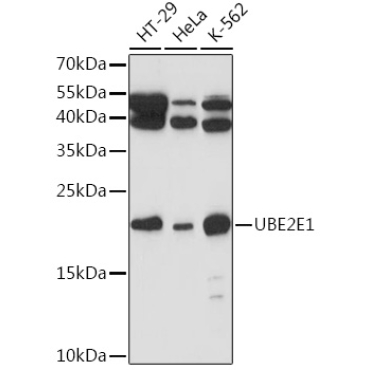 UBE2E1 Rabbit Polyclonal Antibody