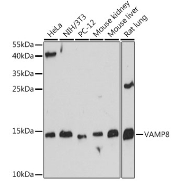 VAMP8 Rabbit Polyclonal Antibody