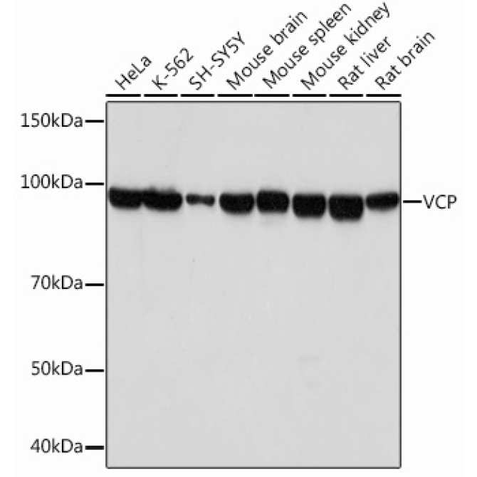VCP Rabbit Monoclonal Antibody