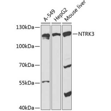 TrKC Rabbit Polyclonal Antibody