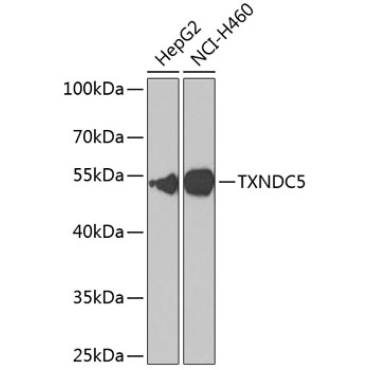 TXNDC5 Rabbit Polyclonal Antibody