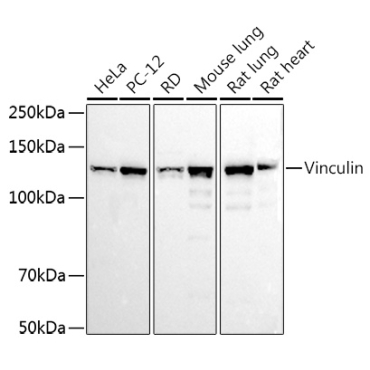 Vinculin Rabbit Polyclonal Antibody