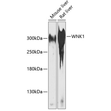 WNK1 Rabbit Polyclonal Antibody