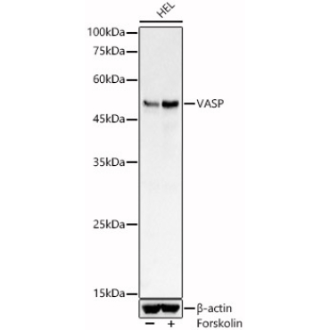 VASP Rabbit Polyclonal Antibody