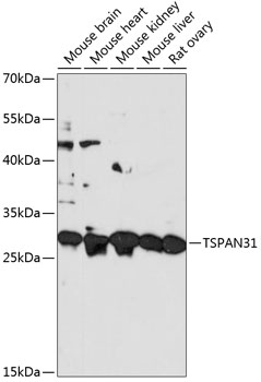 TSPAN31 Rabbit Polyclonal Antibody