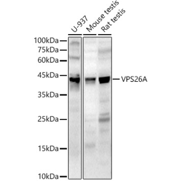 VPS26A Rabbit Polyclonal Antibody