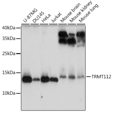 TRMT112 Rabbit Polyclonal Antibody