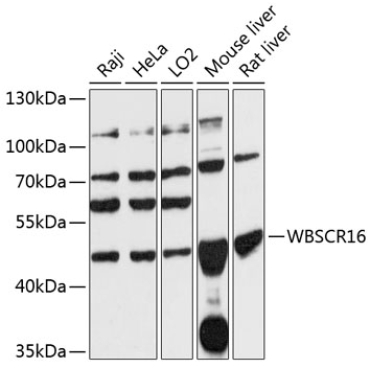 WBSCR16 Rabbit Polyclonal Antibody