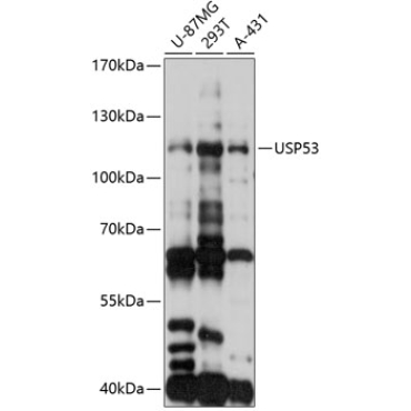 USP53 Rabbit Polyclonal Antibody