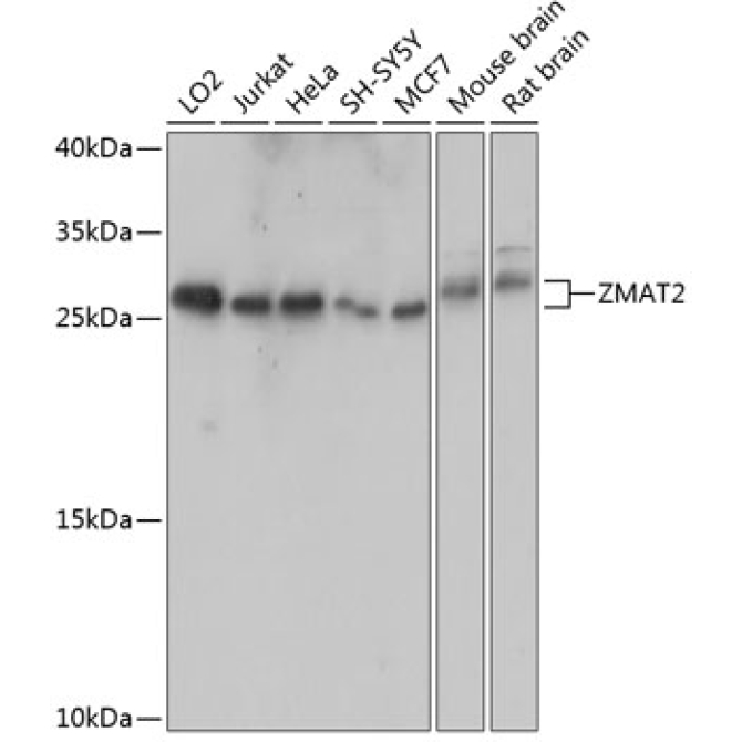 ZMAT2 Rabbit Polyclonal Antibody