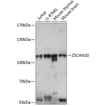 ZSCAN20 Rabbit Polyclonal Antibody