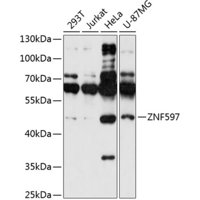 ZNF597 Rabbit Polyclonal Antibody