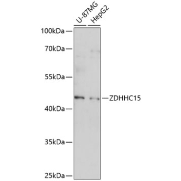 ZDHHC15 Rabbit Polyclonal Antibody