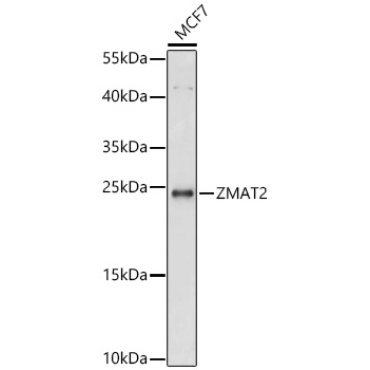 ZMAT2 Rabbit Polyclonal Antibody