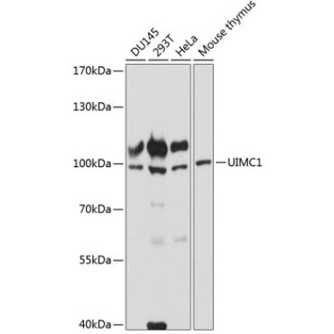 UIMC1 Rabbit Polyclonal Antibody