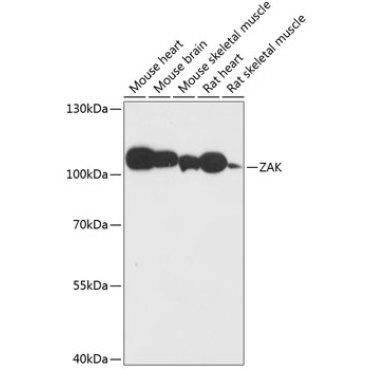 ZAK Rabbit Polyclonal Antibody