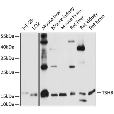 TSHB Rabbit Polyclonal Antibody