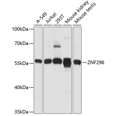 ZNF296 Rabbit Polyclonal Antibody