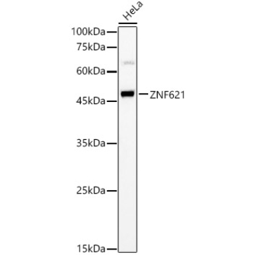 ZNF621 Rabbit Polyclonal Antibody