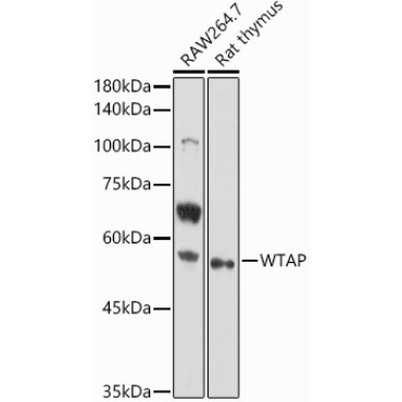 WTAP Rabbit Polyclonal Antibody