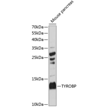 TYROBP Rabbit Polyclonal Antibody