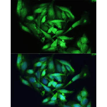 XBP1 Rabbit Polyclonal Antibody