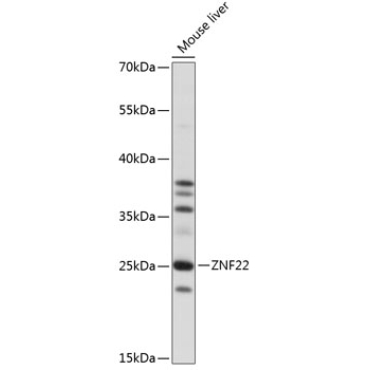 ZNF22 Rabbit Polyclonal Antibody