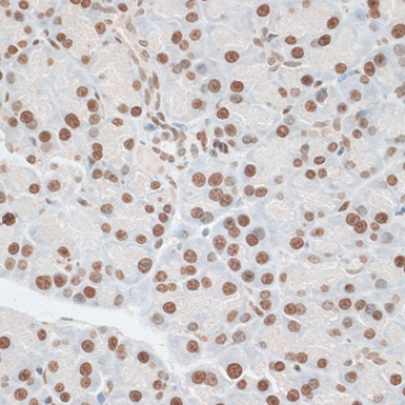 ZNF177 Rabbit Polyclonal Antibody