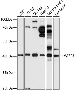 WISP3 Rabbit Polyclonal Antibody