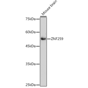 ZNF259 Rabbit Monoclonal Antibody