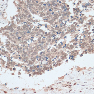ZNF562 Rabbit Polyclonal Antibody