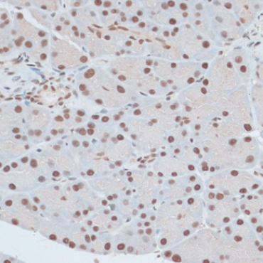 ZNF416 Rabbit Polyclonal Antibody