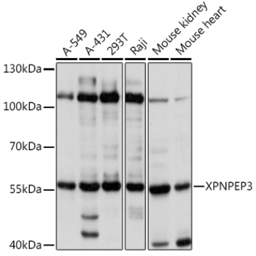 XPNPEP3 Rabbit Polyclonal Antibody