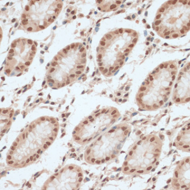 ZNF574 Rabbit Polyclonal Antibody