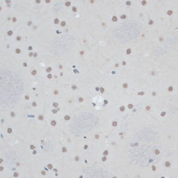 ZNF433 Rabbit Polyclonal Antibody