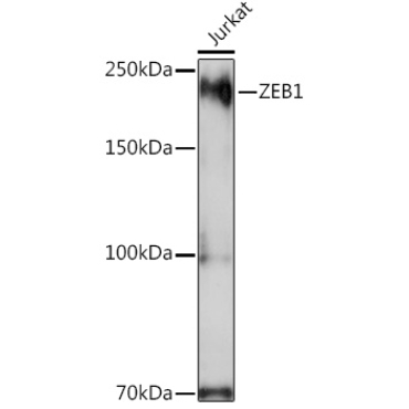 ZEB1 Rabbit Polyclonal Antibody
