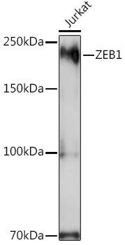 ZEB1 Rabbit Polyclonal Antibody