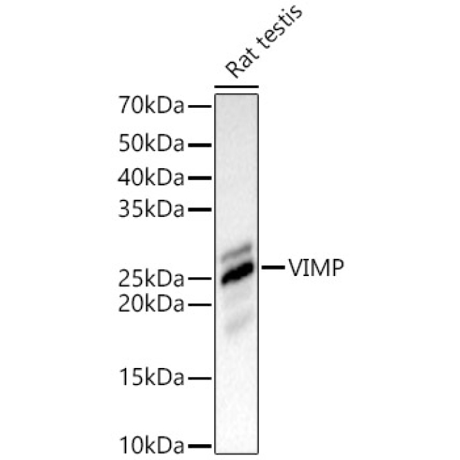VIMP Rabbit Polyclonal Antibody