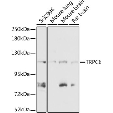 TRPC6 Rabbit Polyclonal Antibody
