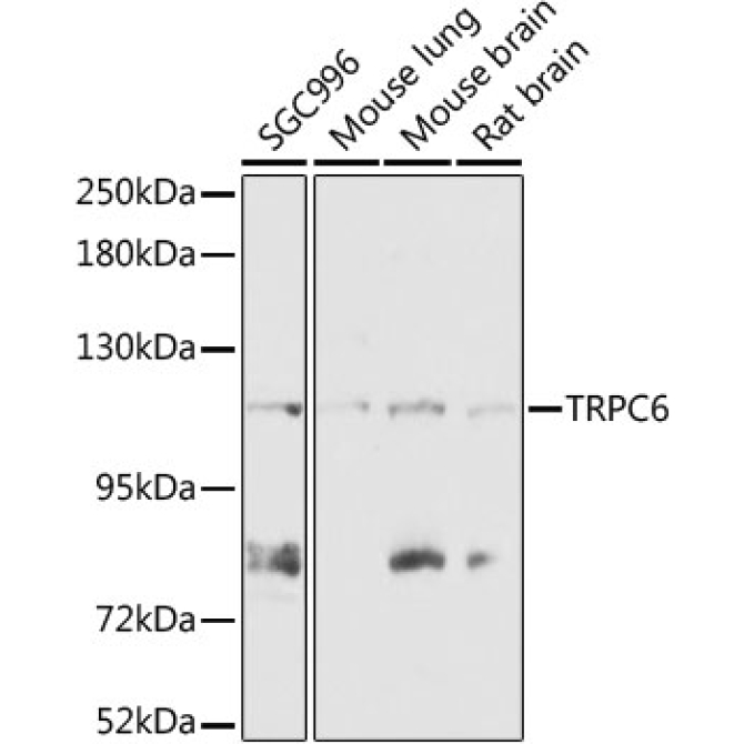 TRPC6 Rabbit Polyclonal Antibody
