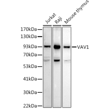 VAV1 Rabbit Polyclonal Antibody