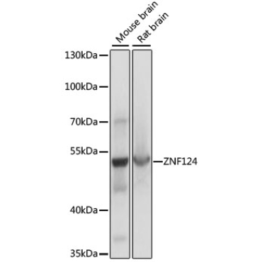 ZNF124 Rabbit Polyclonal Antibody