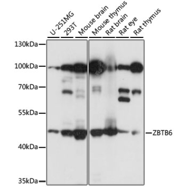 ZBTB6 Rabbit Polyclonal Antibody