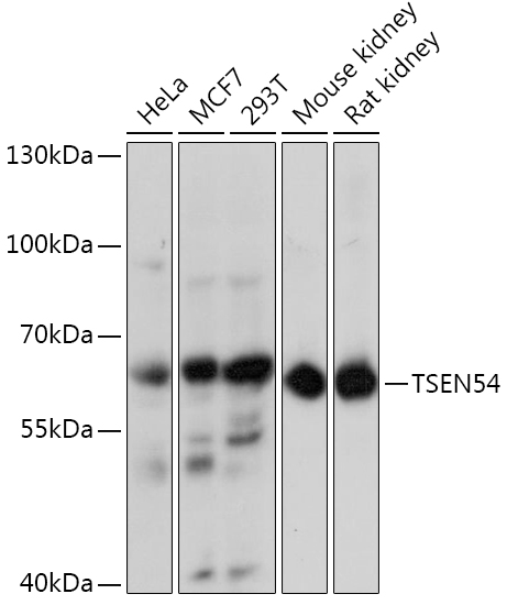 TSEN54 Rabbit Polyclonal Antibody