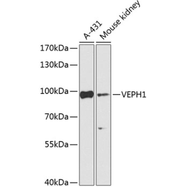VEPH1 Rabbit Polyclonal Antibody