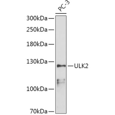 ULK2 Rabbit Polyclonal Antibody