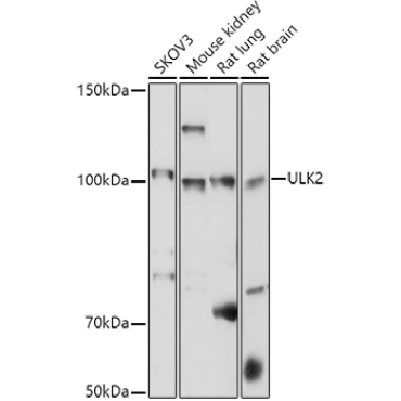 ULK2 Rabbit Polyclonal Antibody
