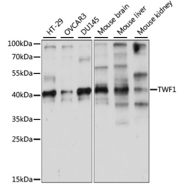 TWF1 Rabbit Polyclonal Antibody